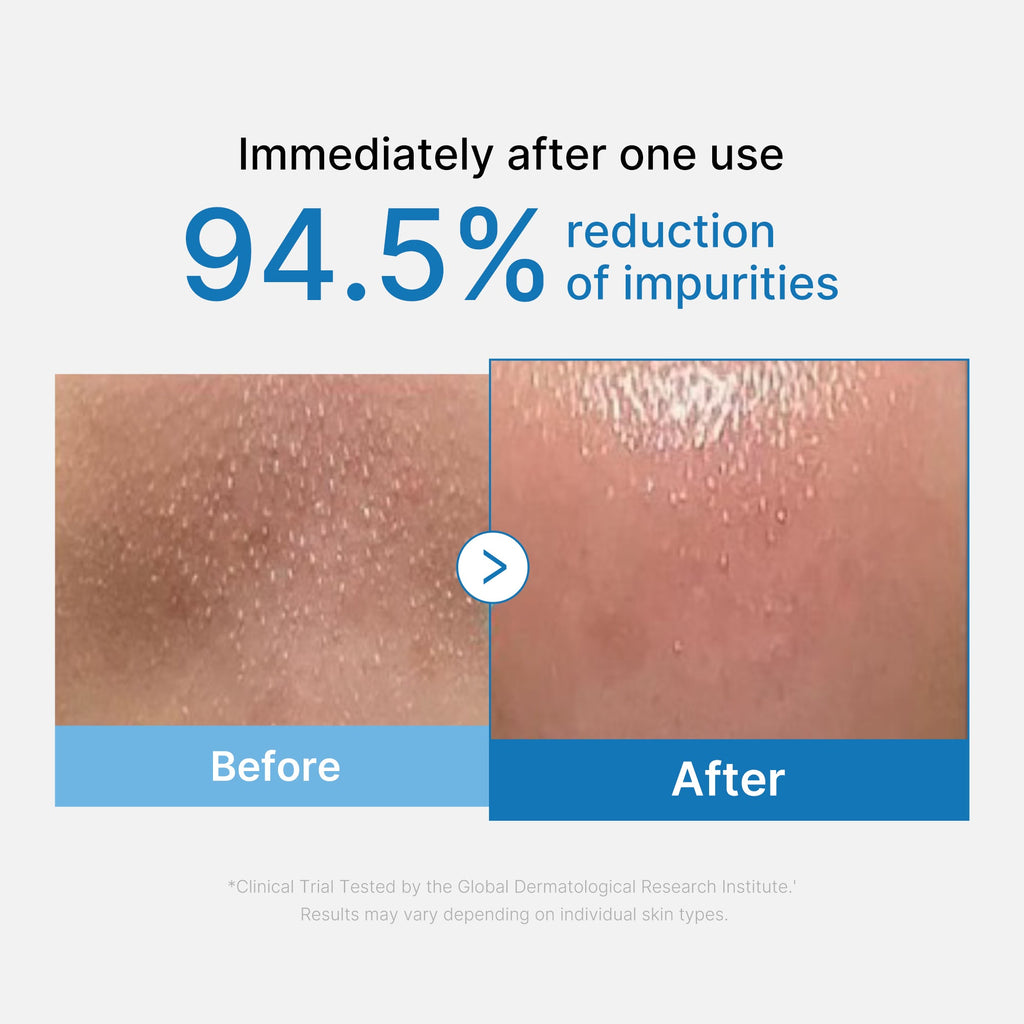 Zero Pore Blackhead Deep Cleansing Oil - Premium Daily Glow