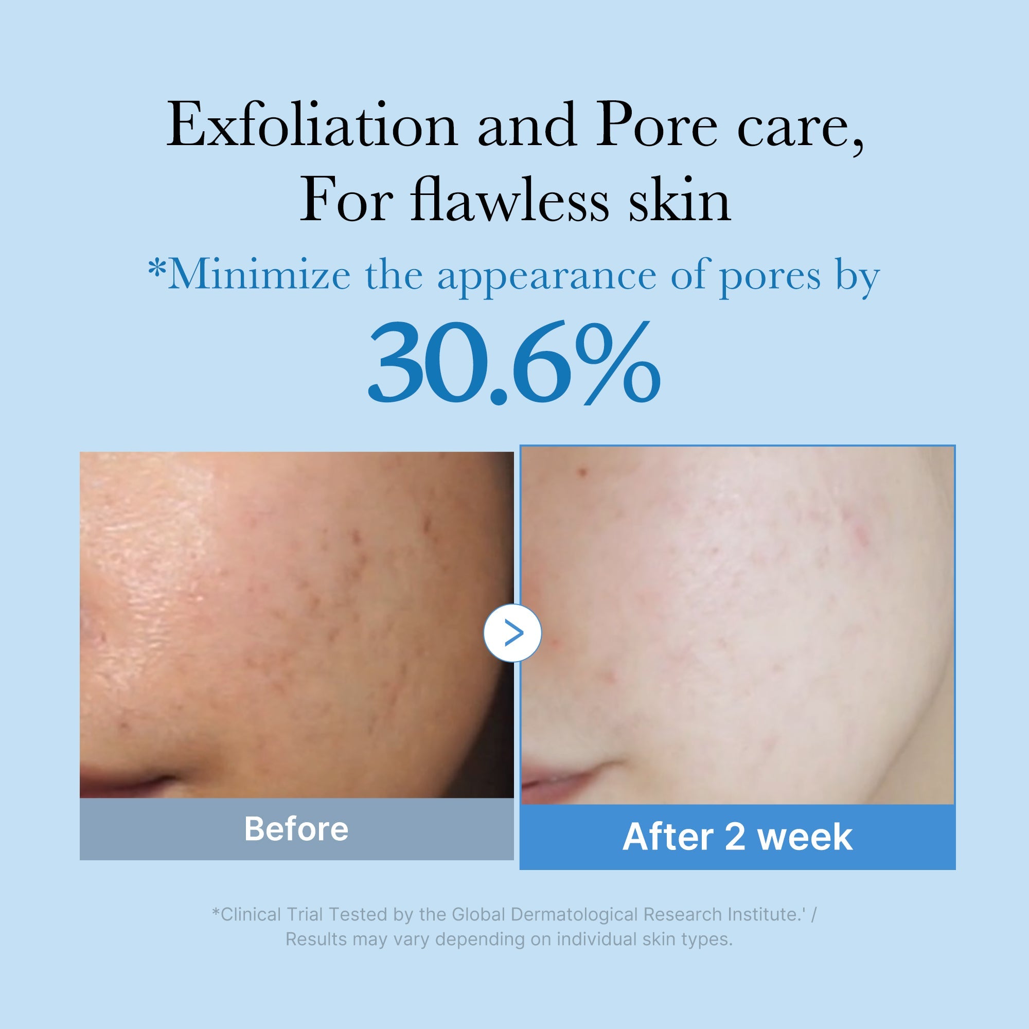 Zero Pore Toner - Smooth Face Care