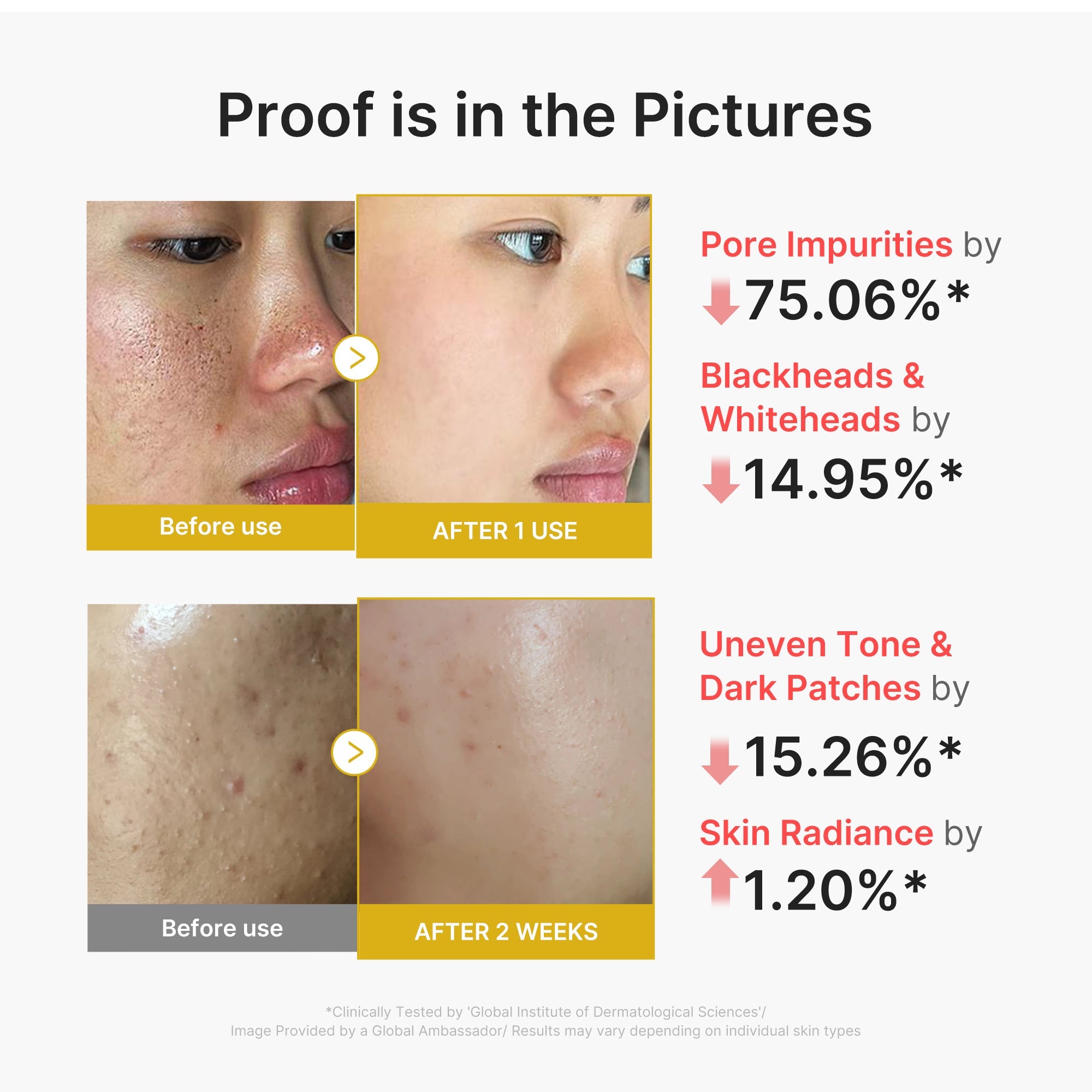 Kojic Acid Turmeric Peel Shot - Daily Routine with Style