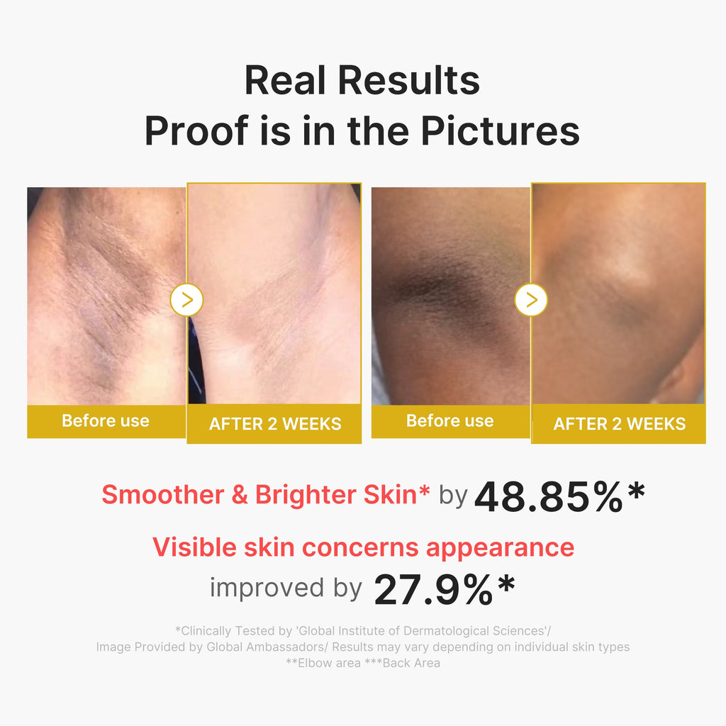 Kojic Acid Turmeric Body Peel Shot - Designed for Modern Care