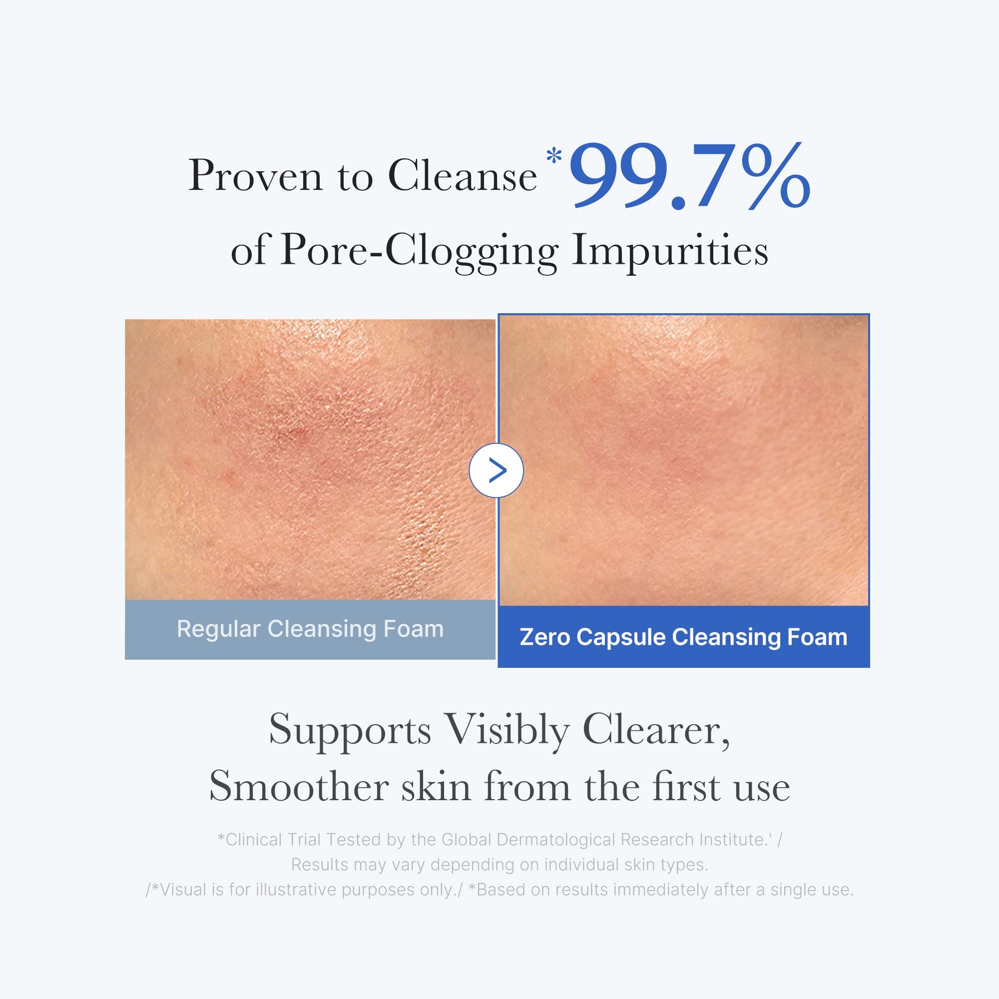 [GIFT] Zero Pore Capsule Cleansing Foam - Smooth. Modern. Medicube.