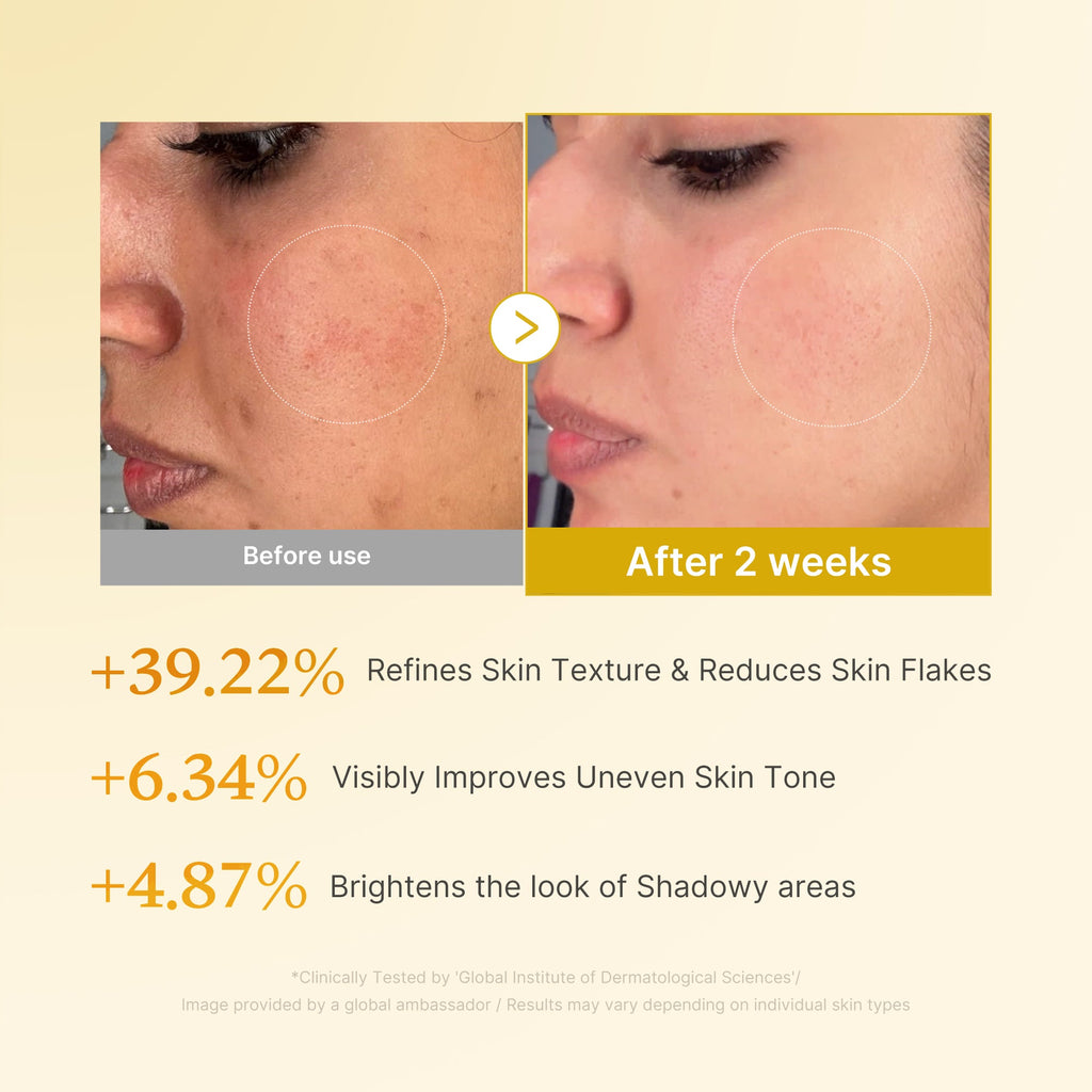 [Subscr.] Kojic Acid Turmeric Toner - Everyday Premium Glow