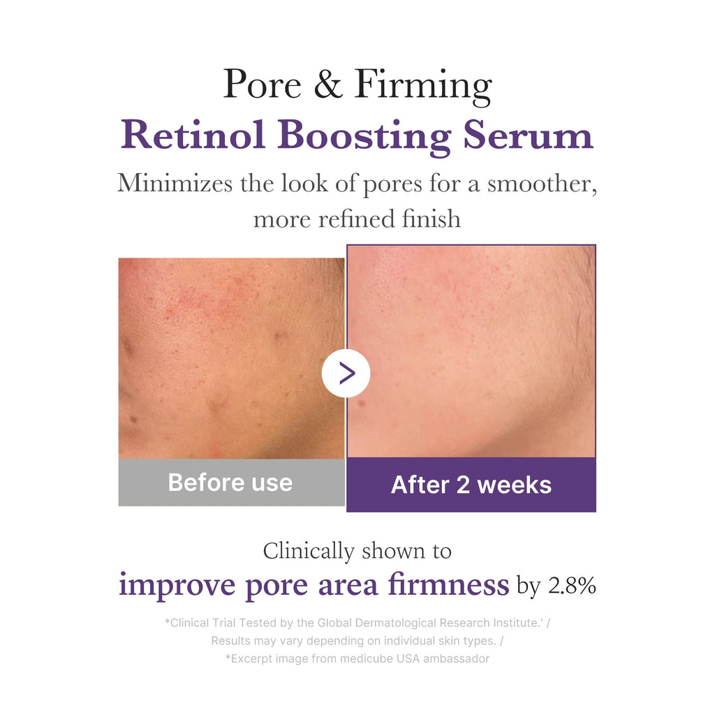 [GIFT] Retinol NMN Boosting Serum - Elevate Your Face Care