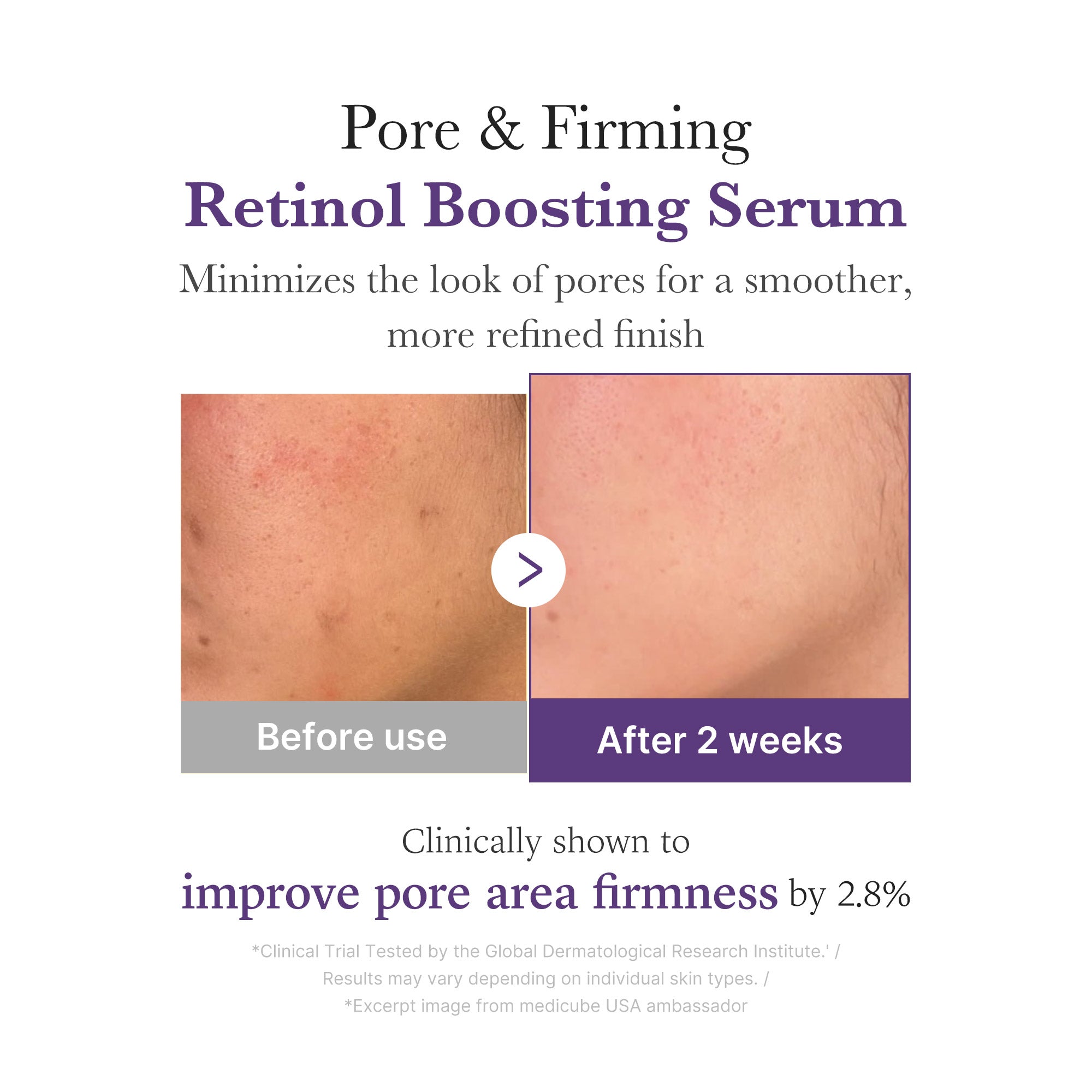 [GIFT] Retinol NMN Boosting Serum - Elevate Your Face Care