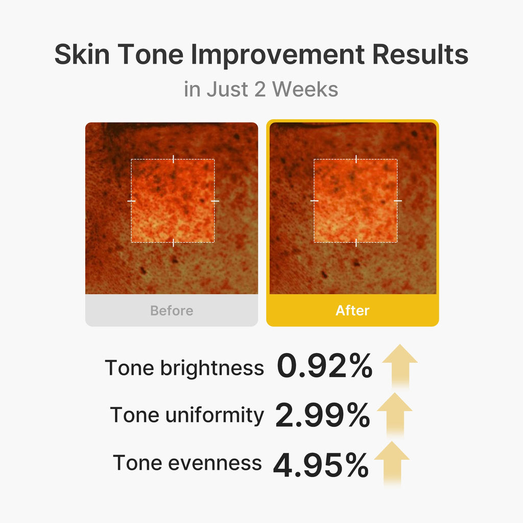 Kojic Acid Turmeric Vita Capsule Cream - Quiet Glow Style