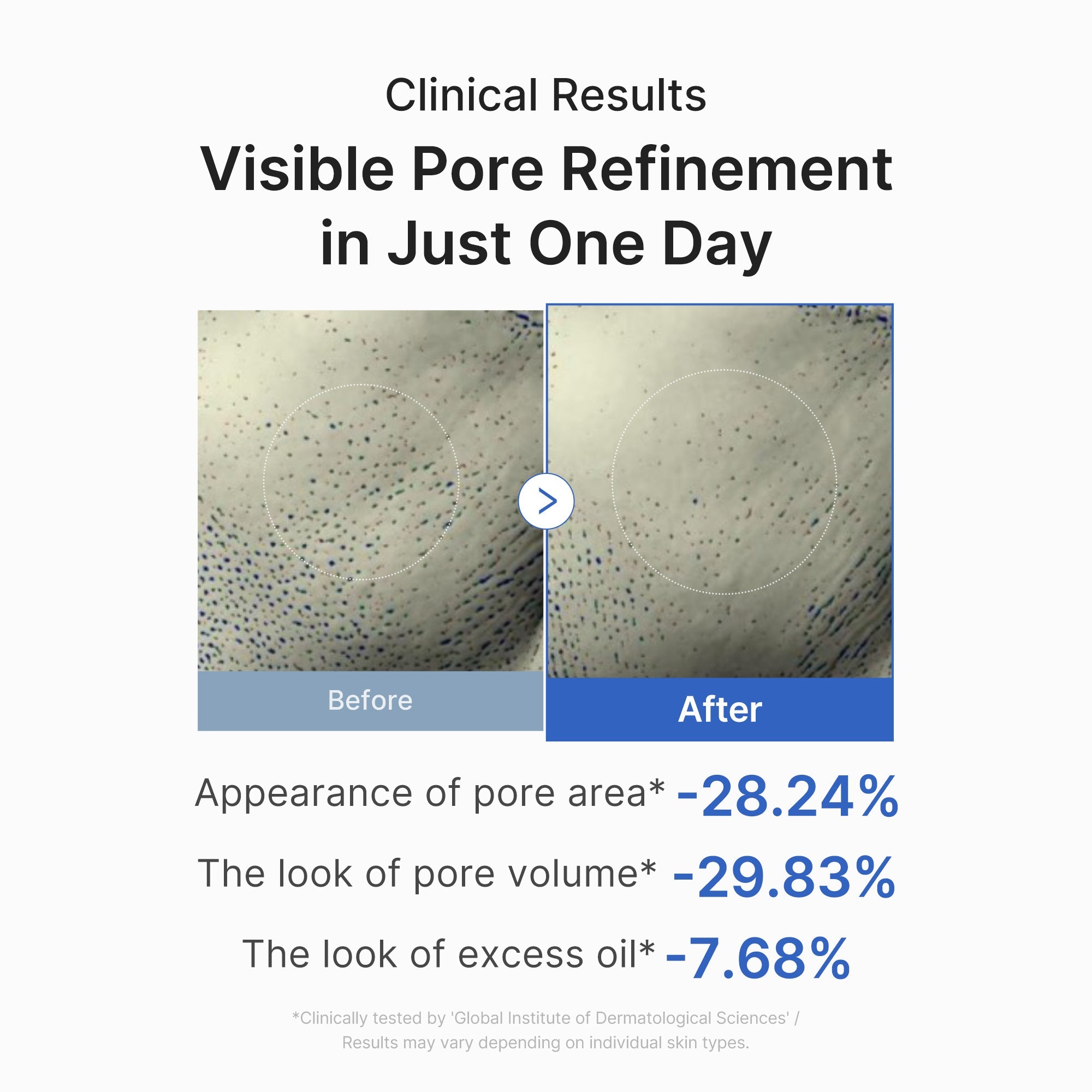 [GIFT] Zero Pore One-day Peptide Serum - Smooth Premium Glow