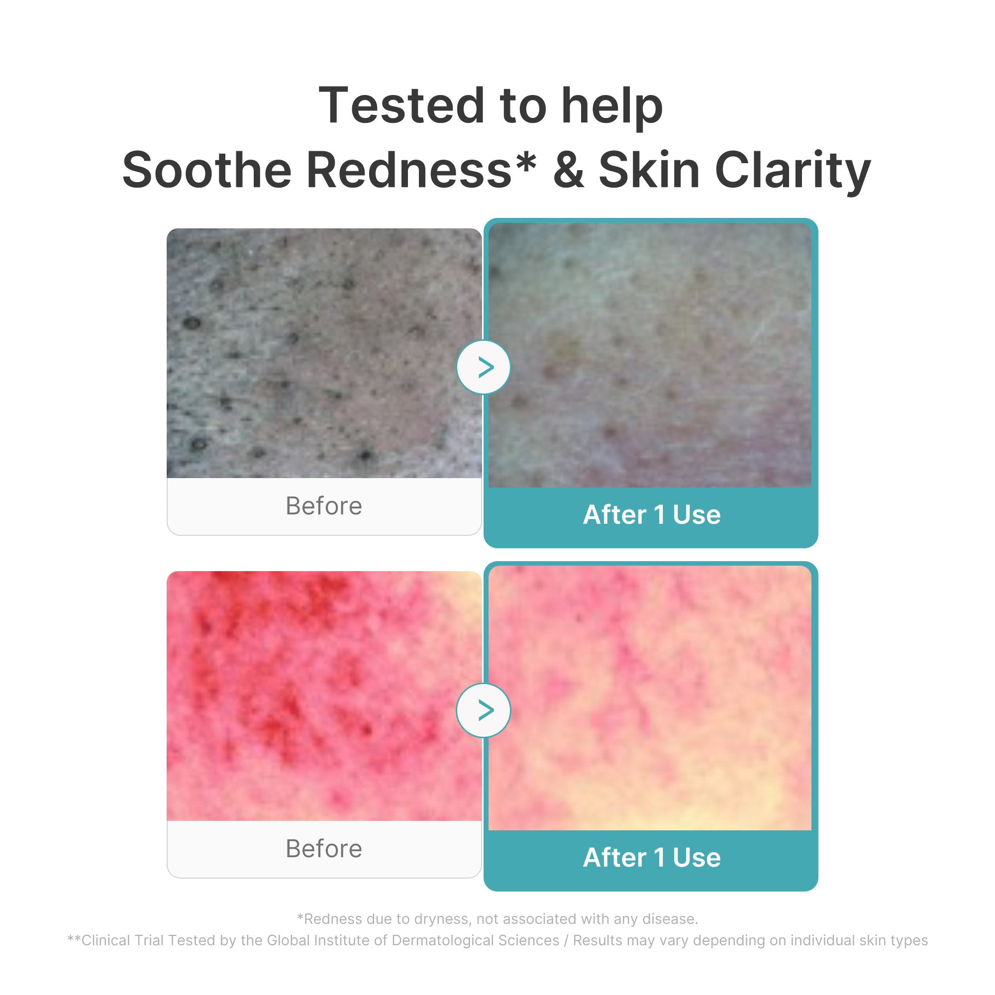 Azelaic Acid Capsule Foam Cleanser - Elevated Glow Favorite