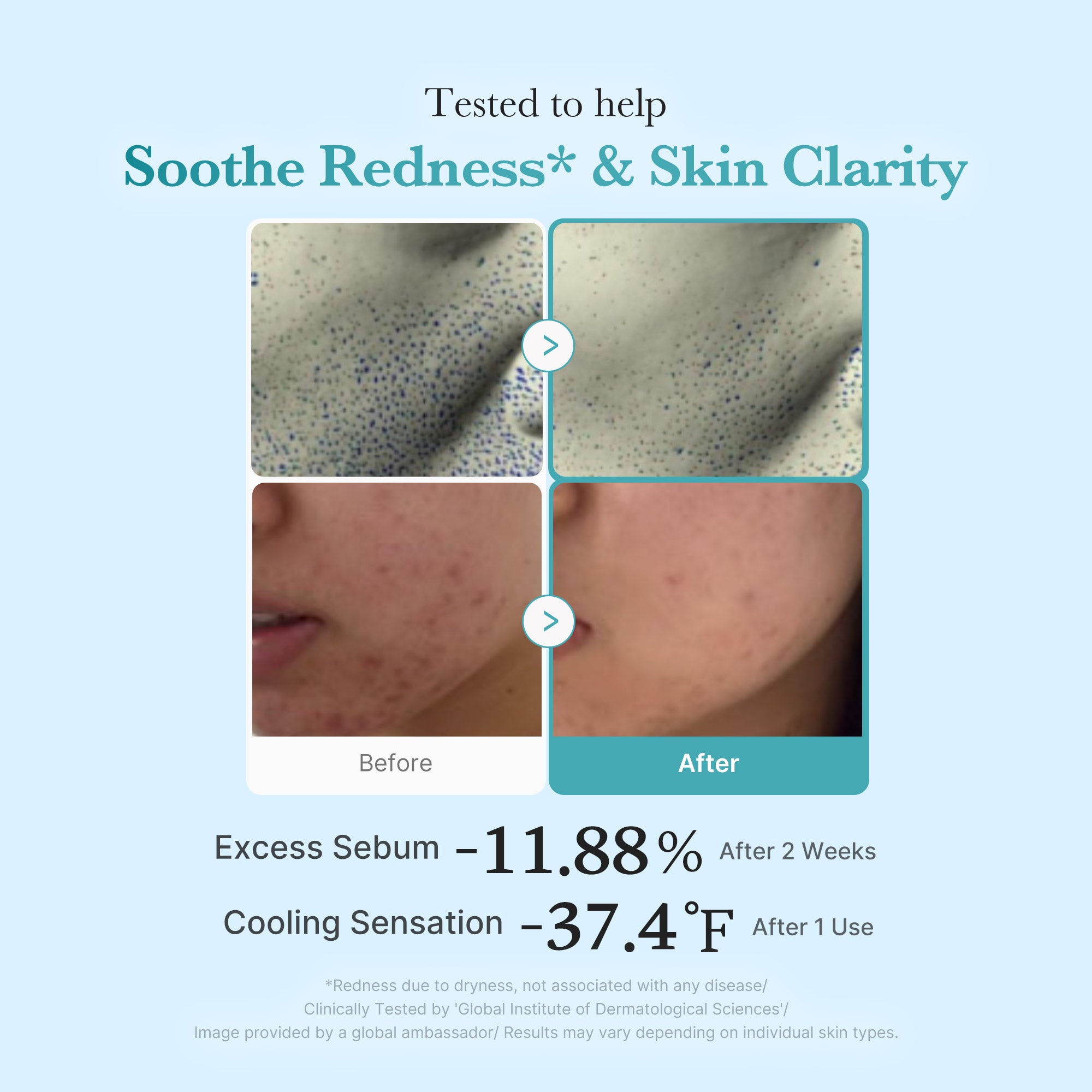 Azelaic Acid Niacinamide Clarifying Toner - Designed for Medicube Days