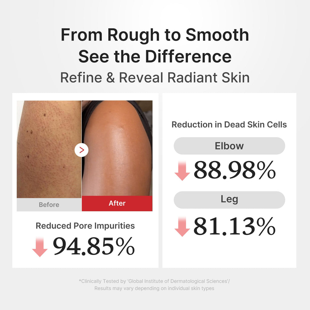 [GIFT] Hypochlorous Acid Rice Body Peel Shot - Glow Care Made Elegant