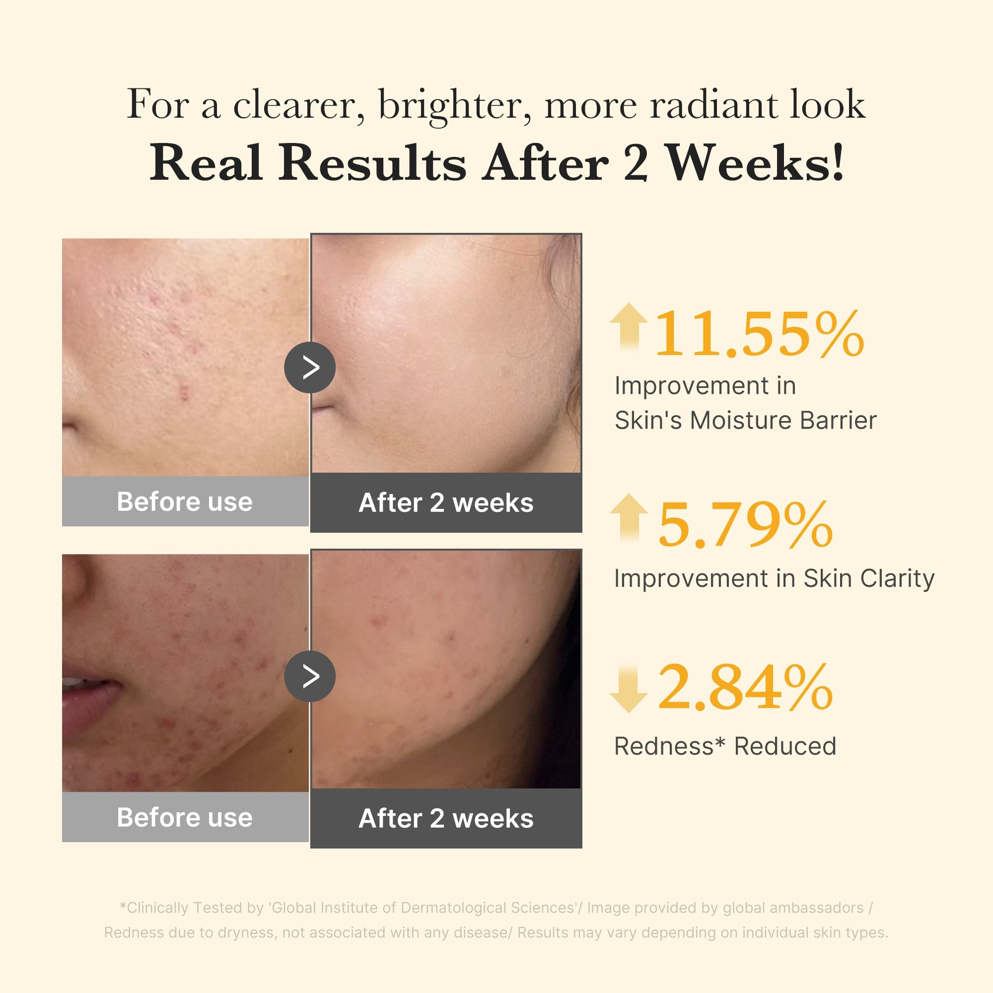Kojic Acid Turmeric Capsule Serum - The Refined Daily Care