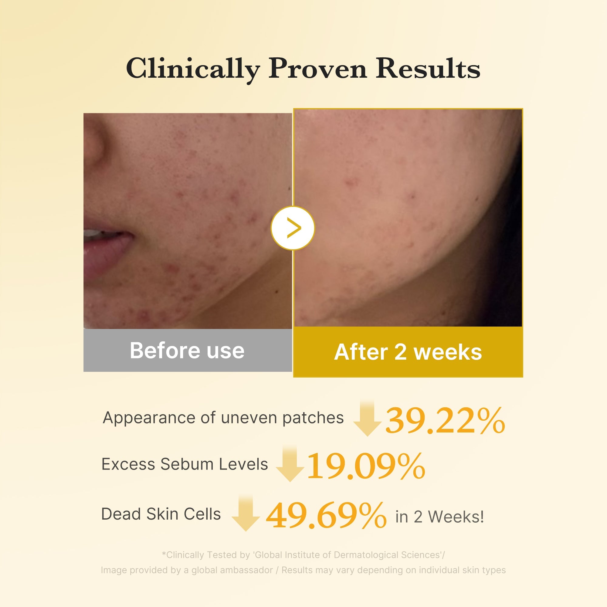 Kojic Acid Tumeric Toner Pad - The Glow Care Edit
