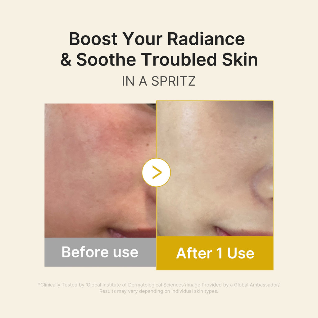 Kojic Acid Turmeric Vitamin Gold Jelly Mist Serum - Modern Face Care Style