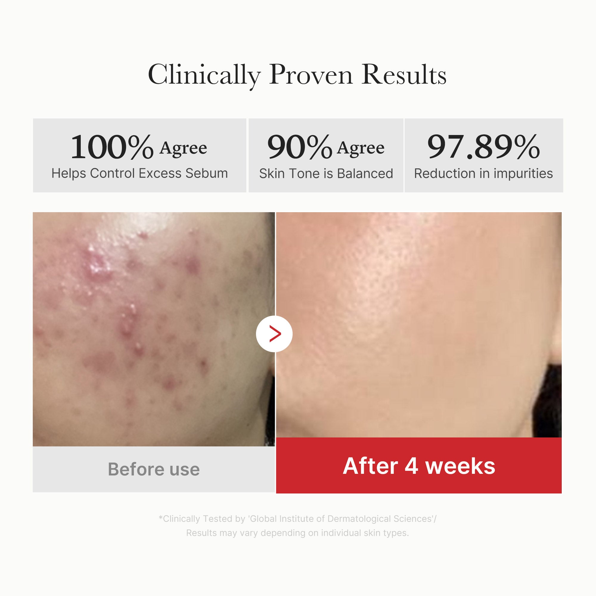 Red Succinic Acid Panthenol Pads - Refined Routine Favorite