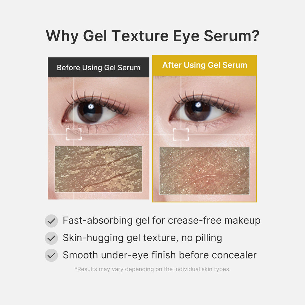 Kojic Acid Tumeric Eye Gel Serum - Effortless Daily Glow