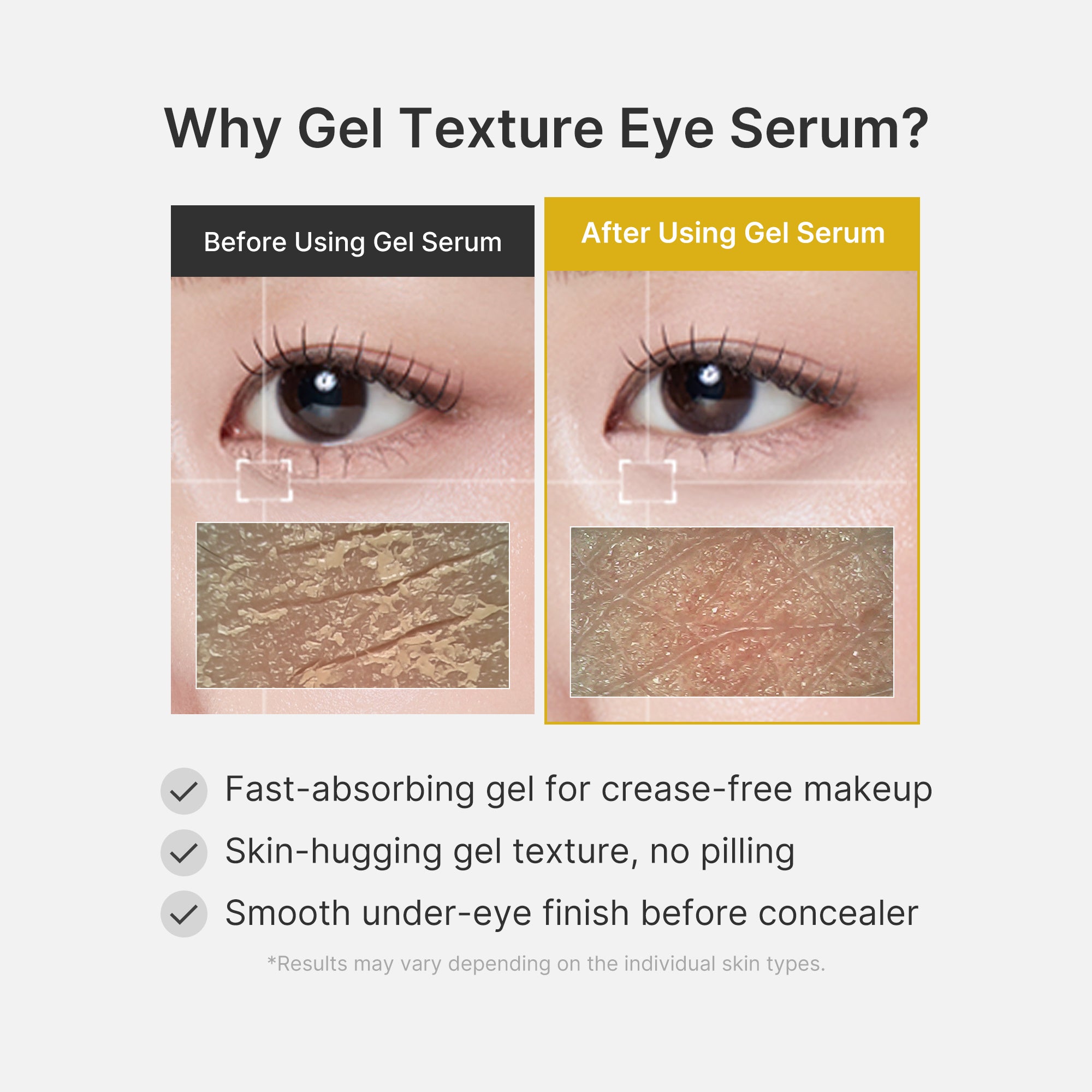 Kojic Acid Tumeric Eye Gel Serum - Effortless Daily Glow