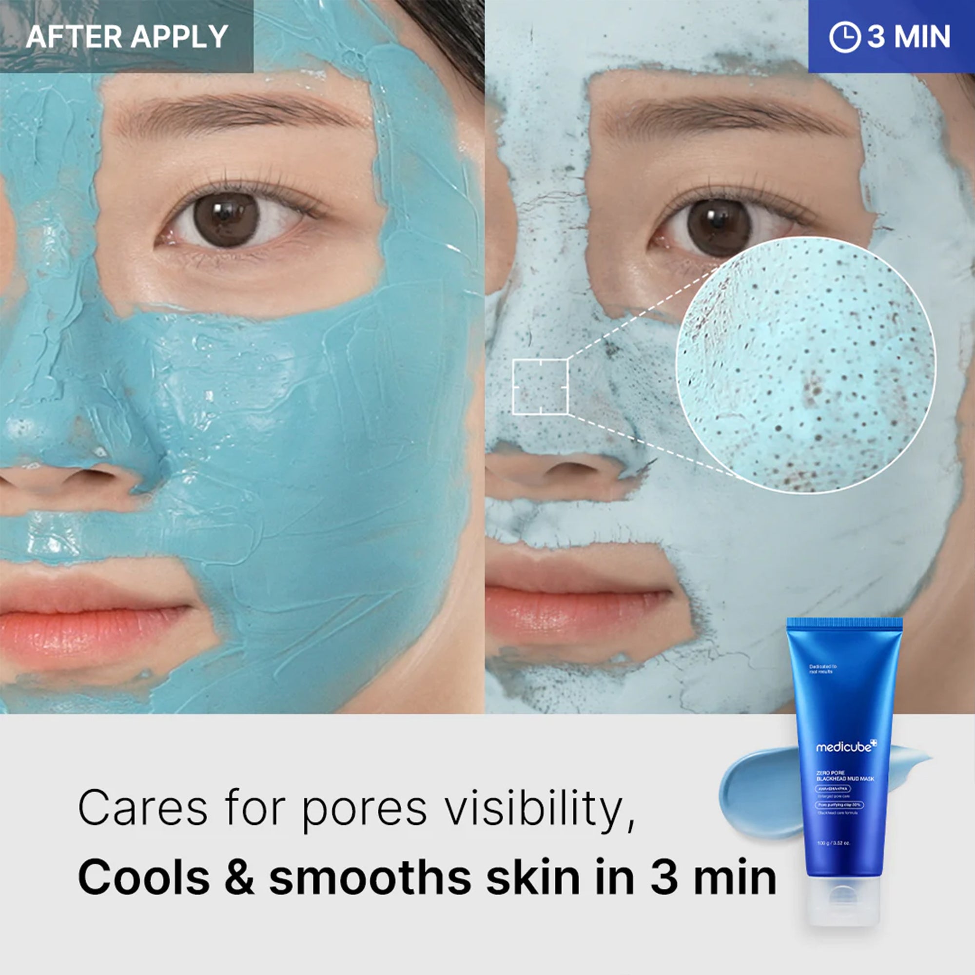 Zero Pore Blackhead Mud Mask - Premium Glow Favorite