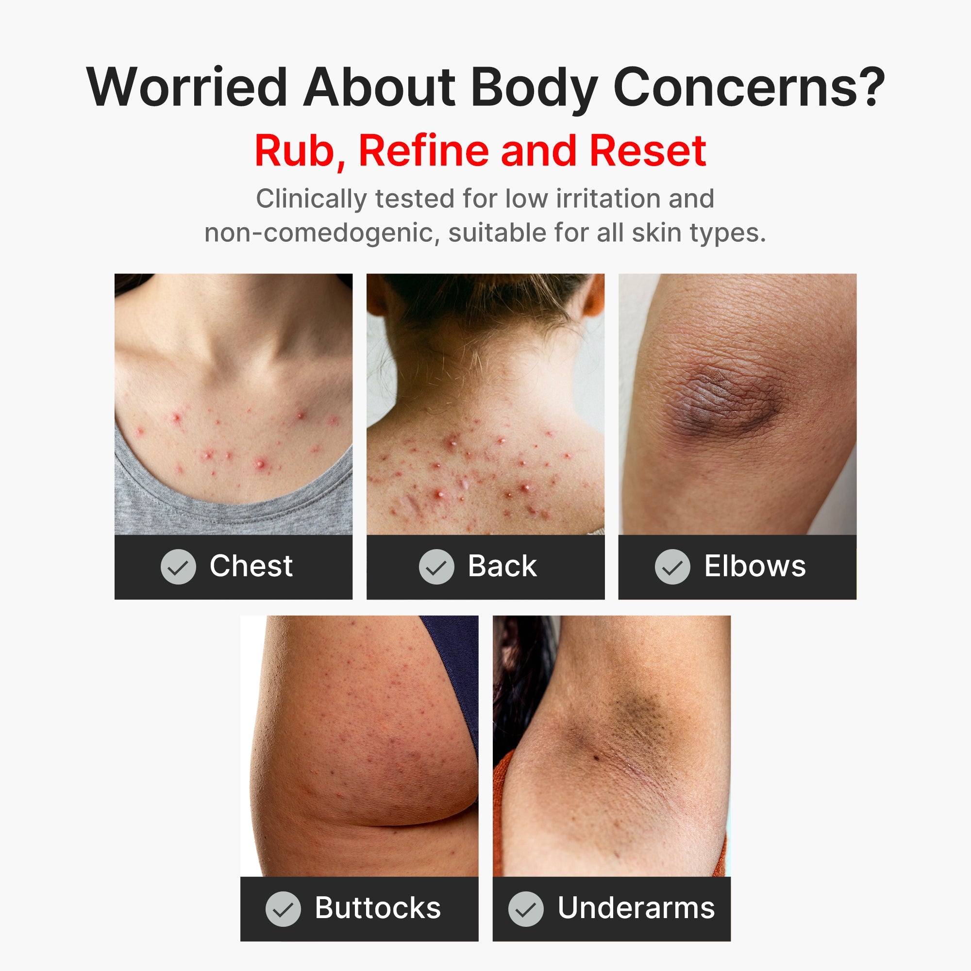 Kojic Acid Turmeric Body Peel Shot - Designed for Modern Care