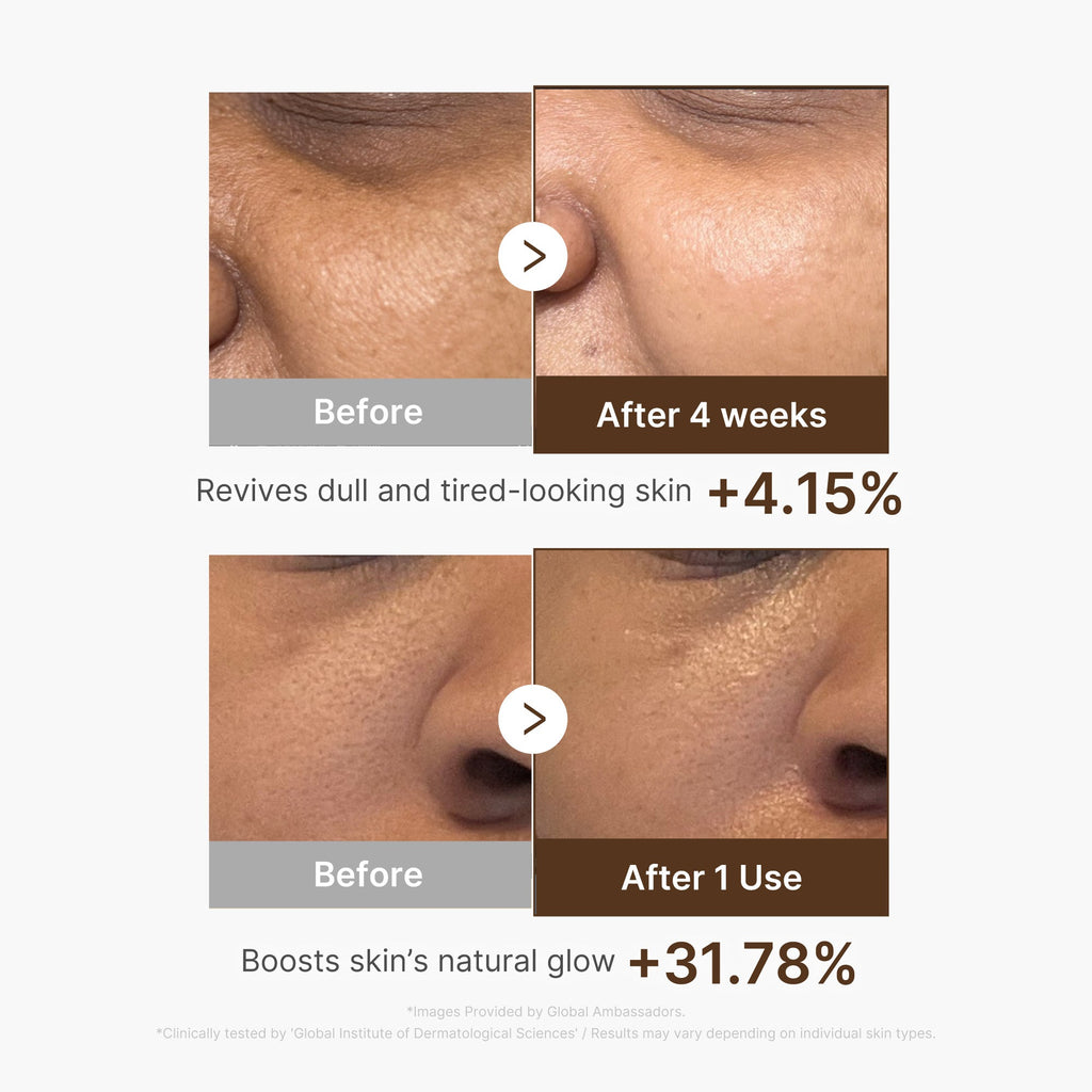 Deep Vitamin C Capsule Serum - Premium Skincare Essential