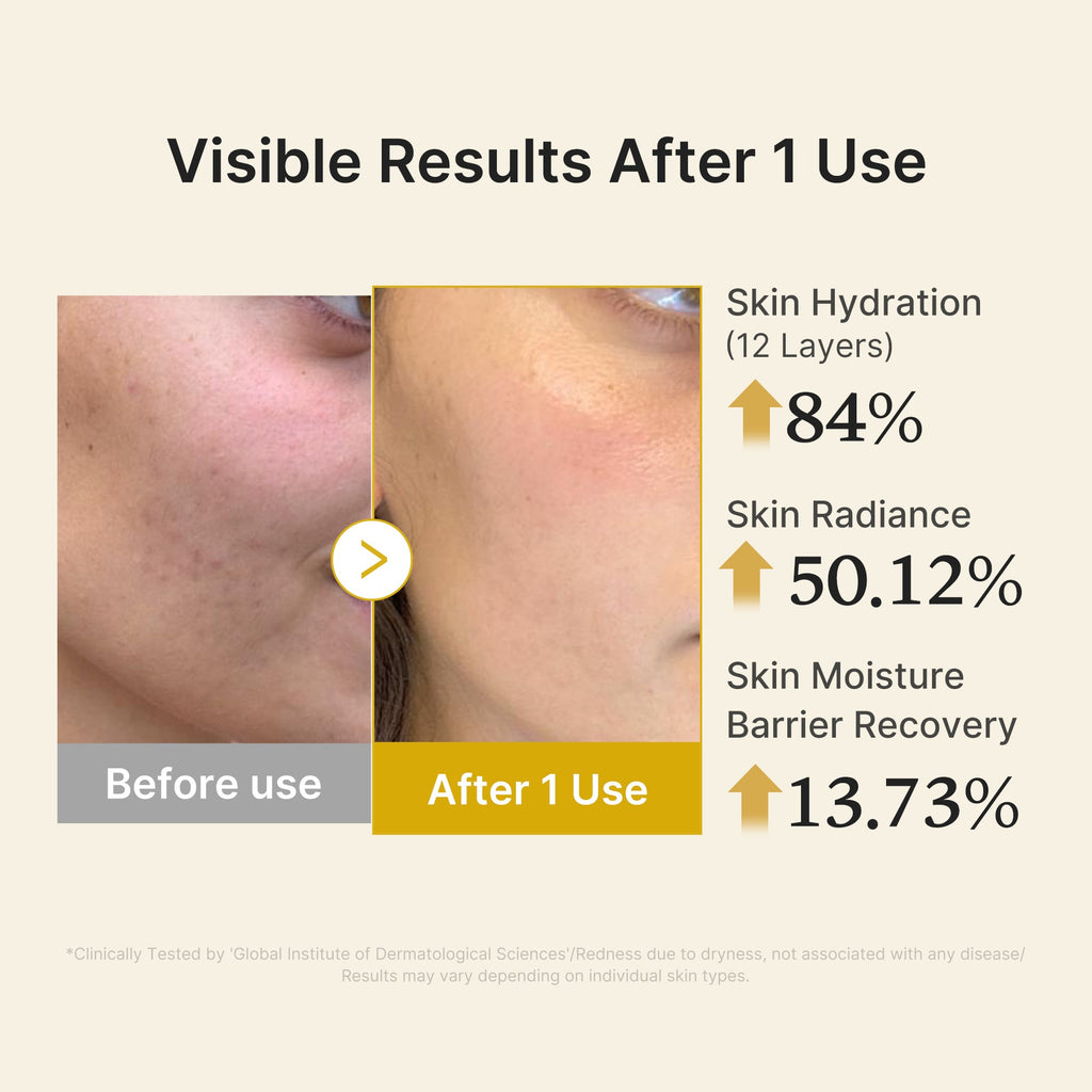Kojic Acid Turmeric Vitamin Gold Jelly Mist Serum - Modern Face Care Style