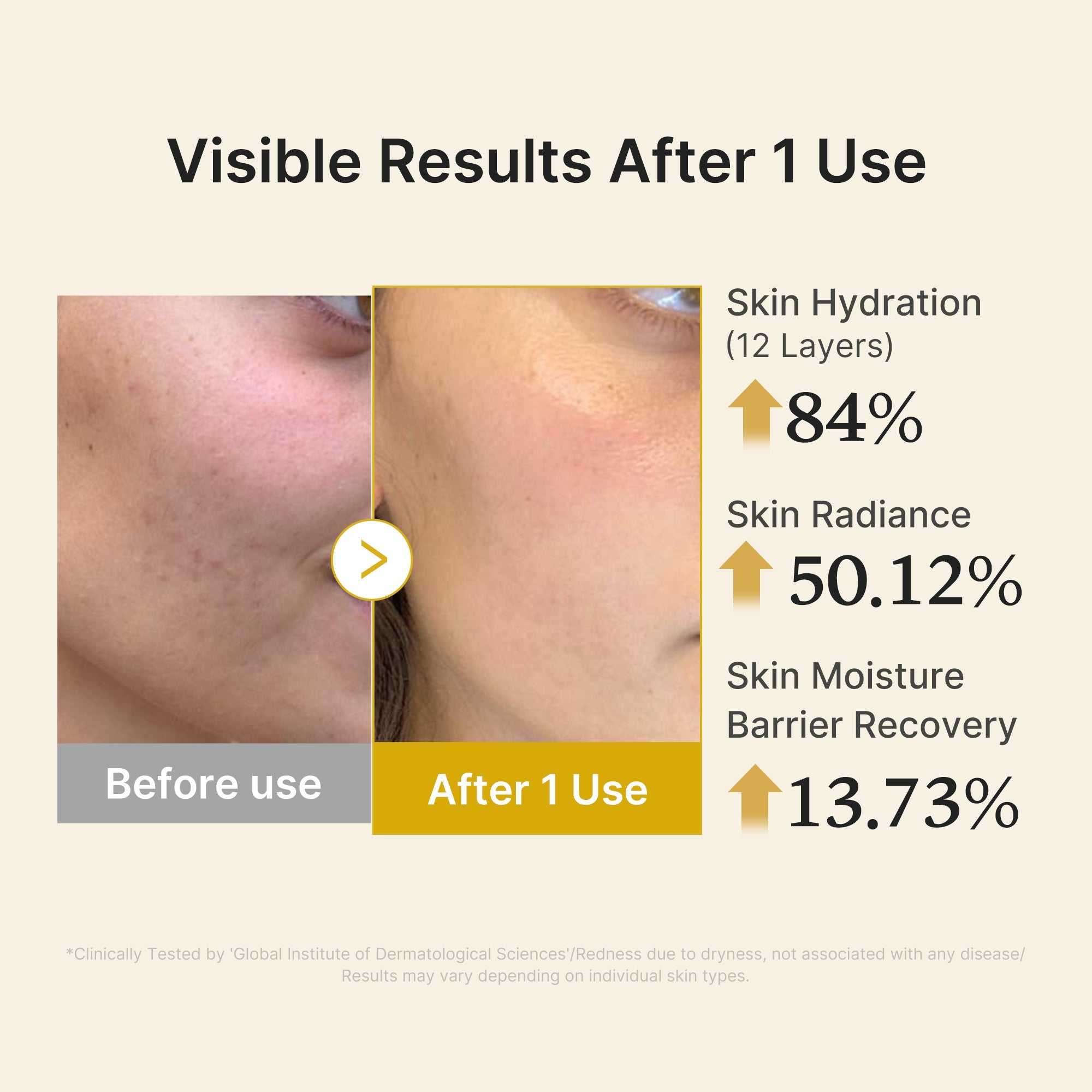 Kojic Acid Turmeric Vitamin Gold Jelly Mist Serum - Modern Face Care Style