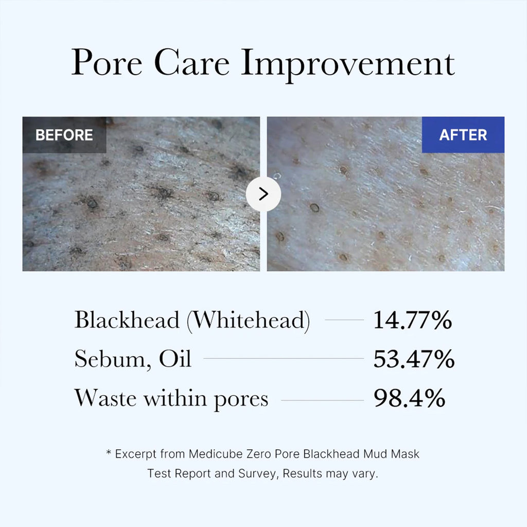 Zero Pore Blackhead Mud Mask - Premium Glow Favorite