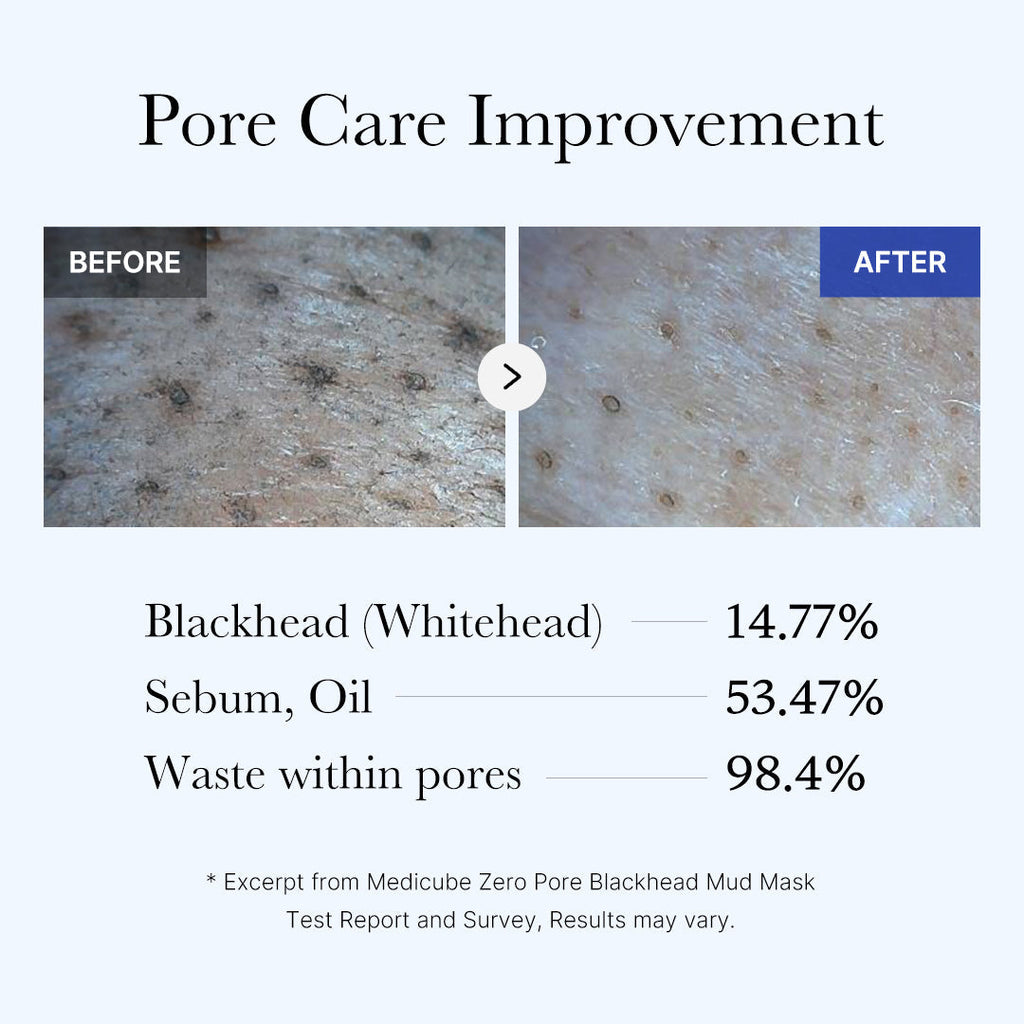 [Subscr.] Zero Pore Blackhead Mud Mask - Refined Feel Daily