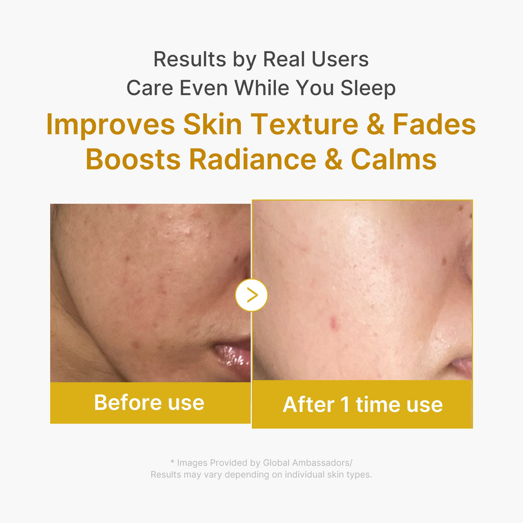 Kojic Acid Turmeric Overnight Wrapping Mask - Premium Care Favorite