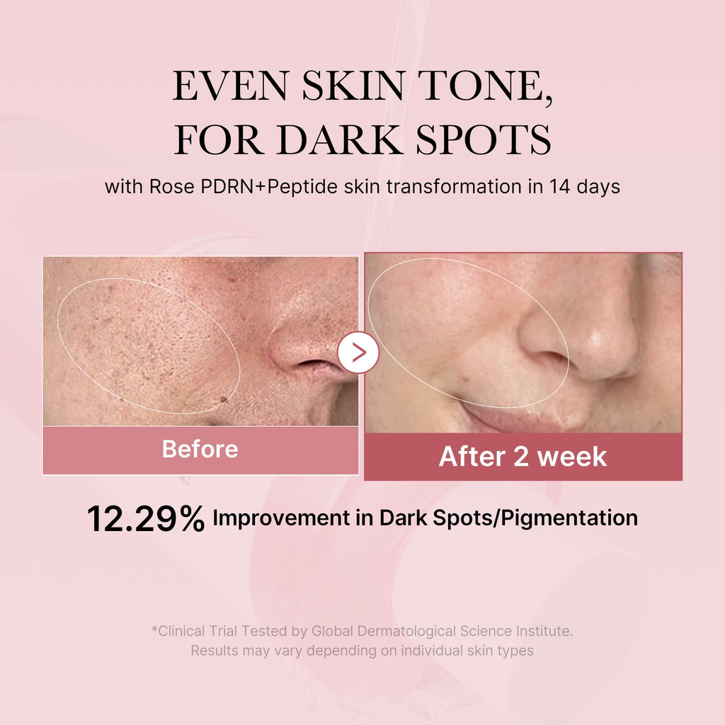 [Subscr.] PDRN Pink Peptide Toner - The Premium Daily Care