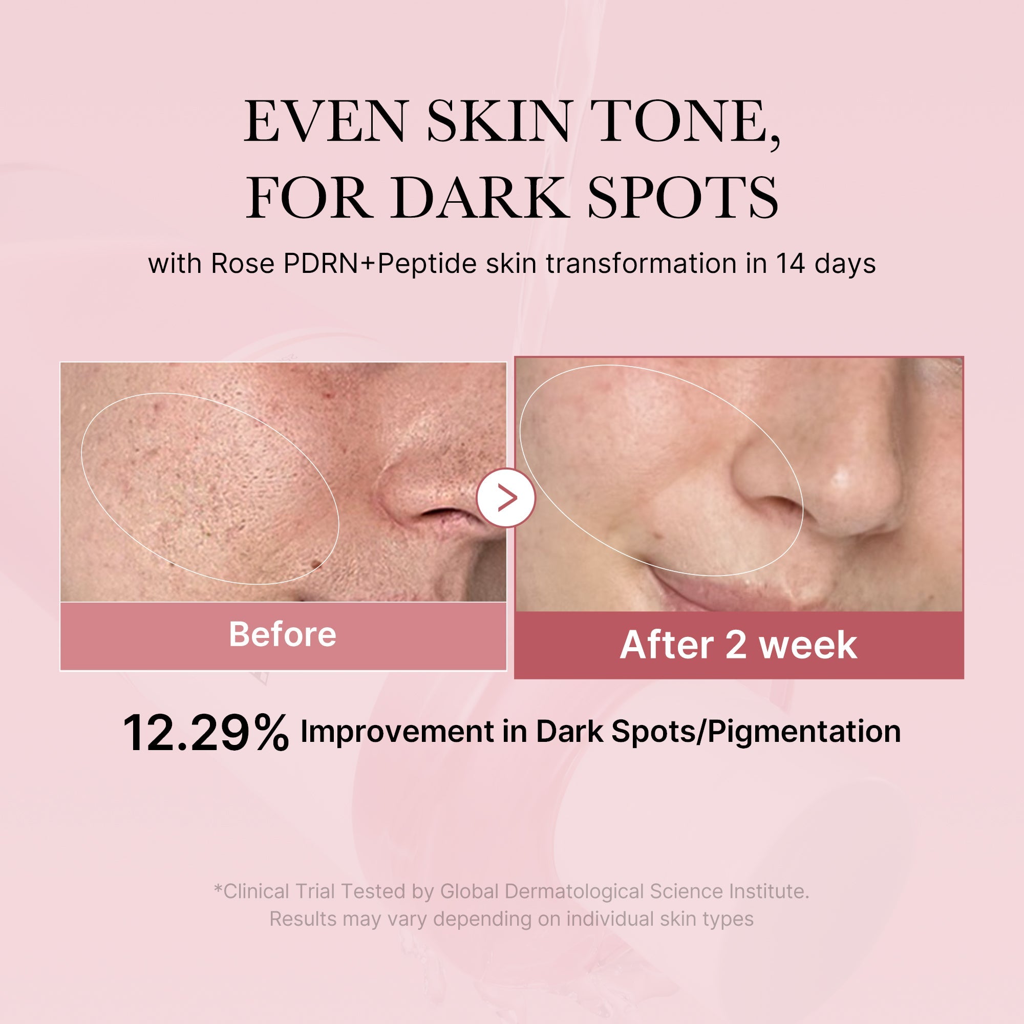 PDRN Pink Peptide Toner - Glow Care Upgraded