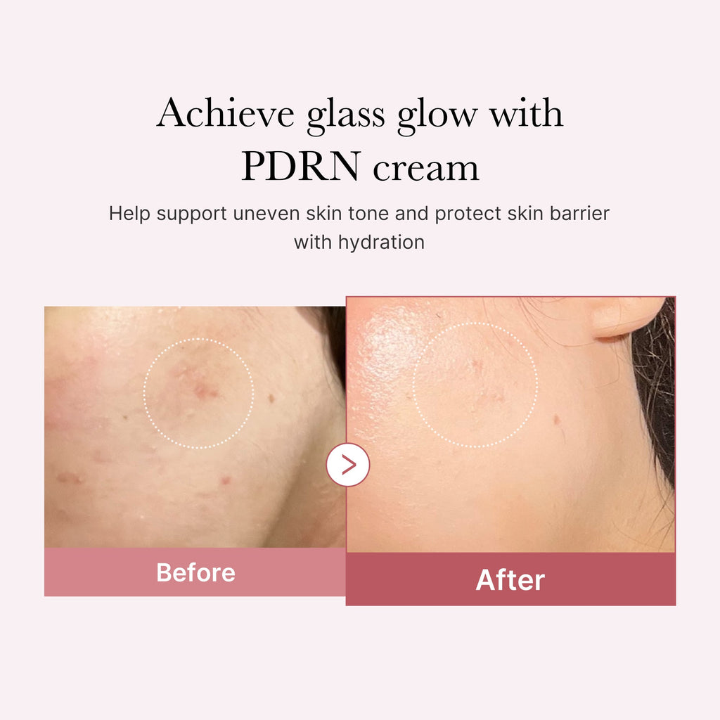 PDRN Pink Peptide Cream - Designed for Daily Glow