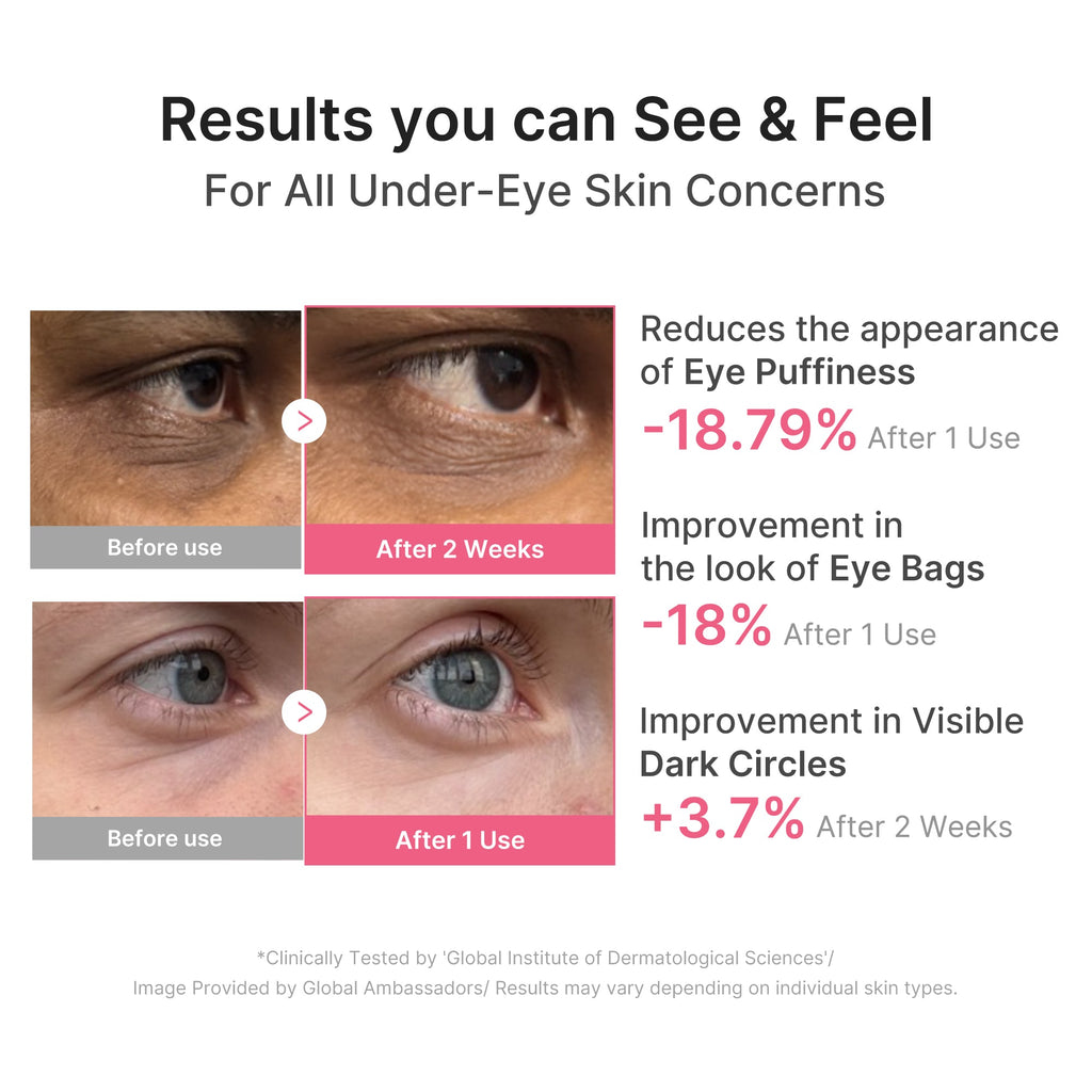 PDRN Caffeine Collagen Eye Patch - Refresh with Polish