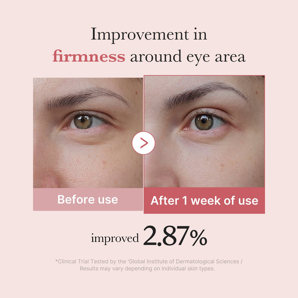 [Subscr.] PDRN Pink Peptide Eye Cream - Medicube Refined Daily
