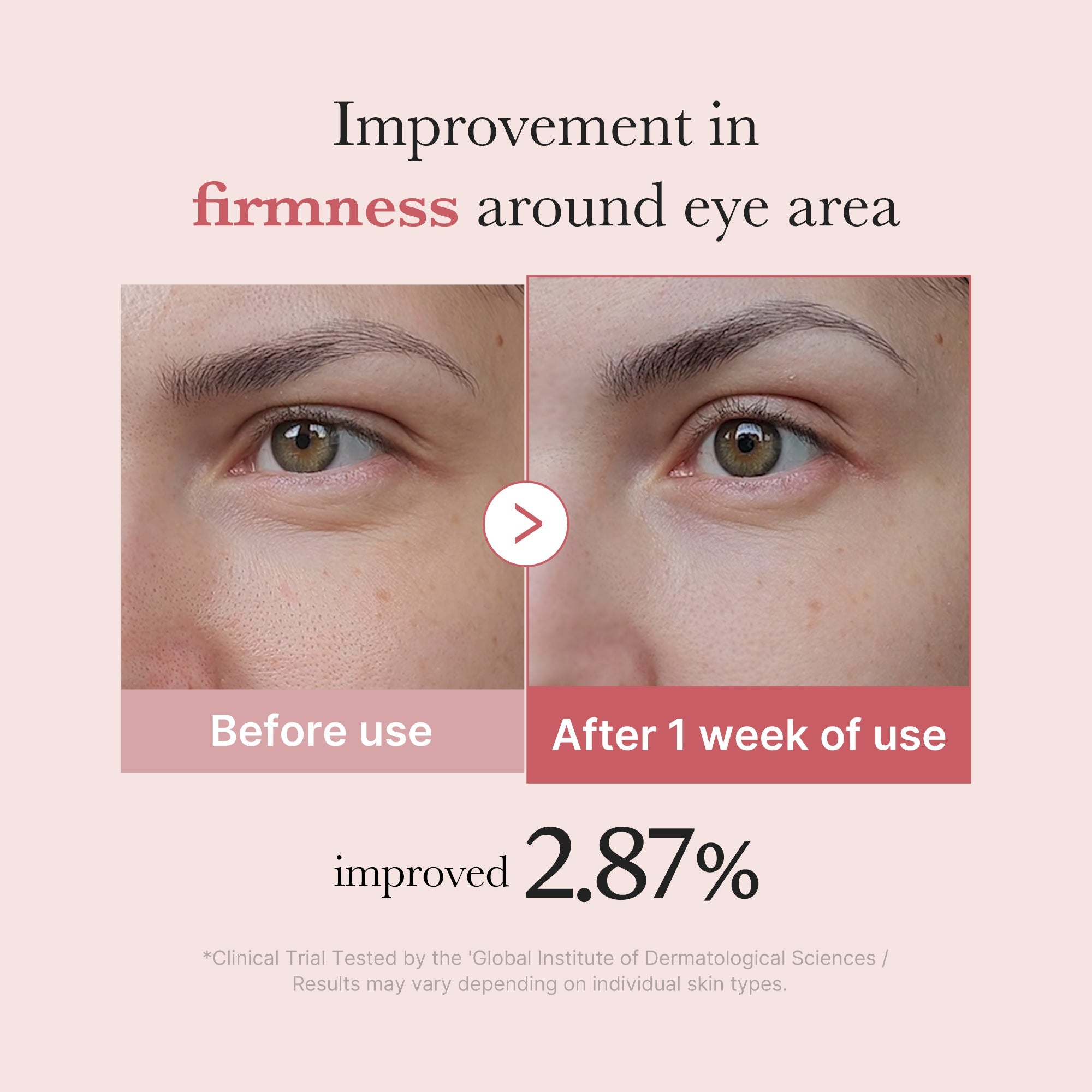 [Subscr.] PDRN Pink Peptide Eye Cream - Medicube Refined Daily