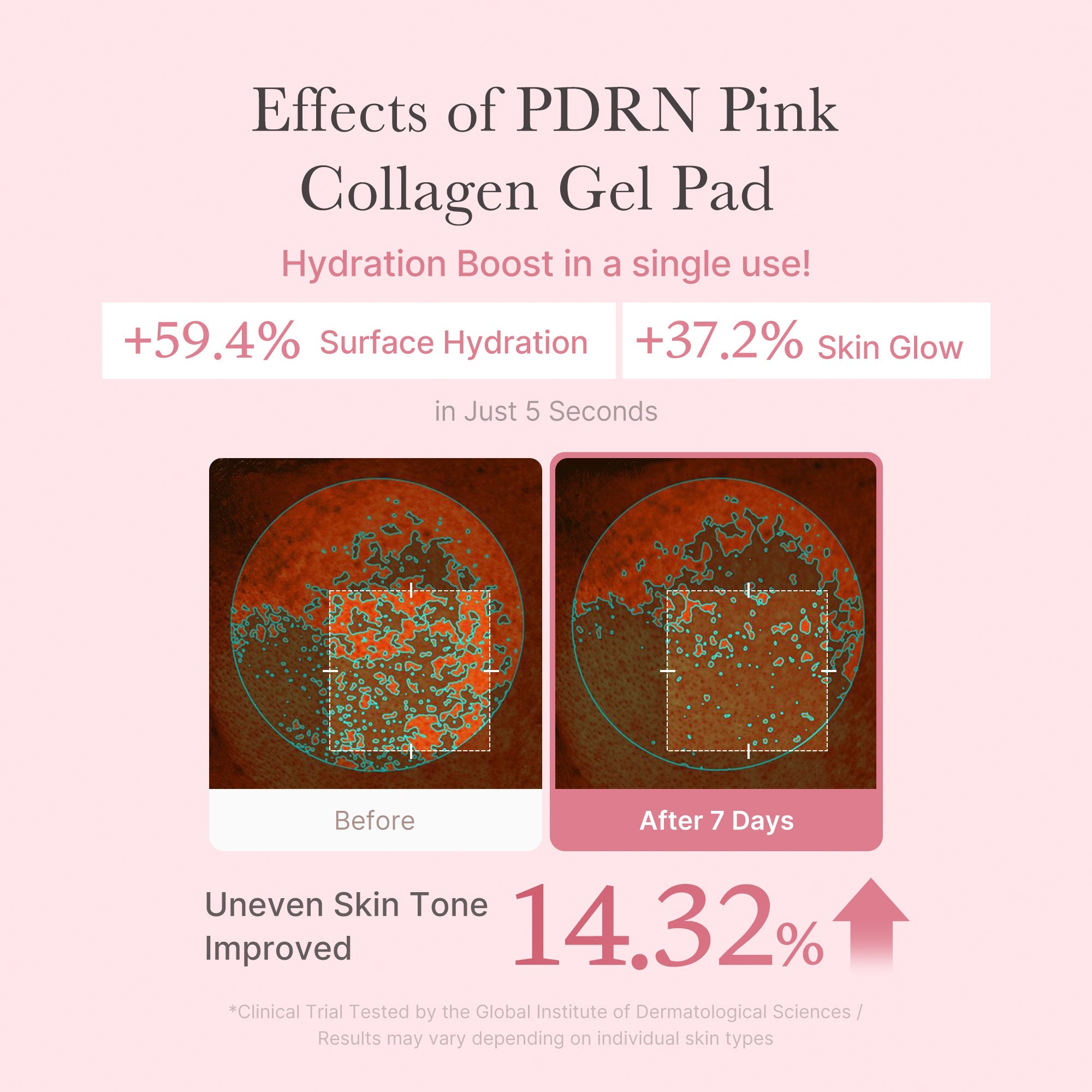 [Subscr.] PDRN Pink Collagen Gel Toner Pad - Routine with Ease
