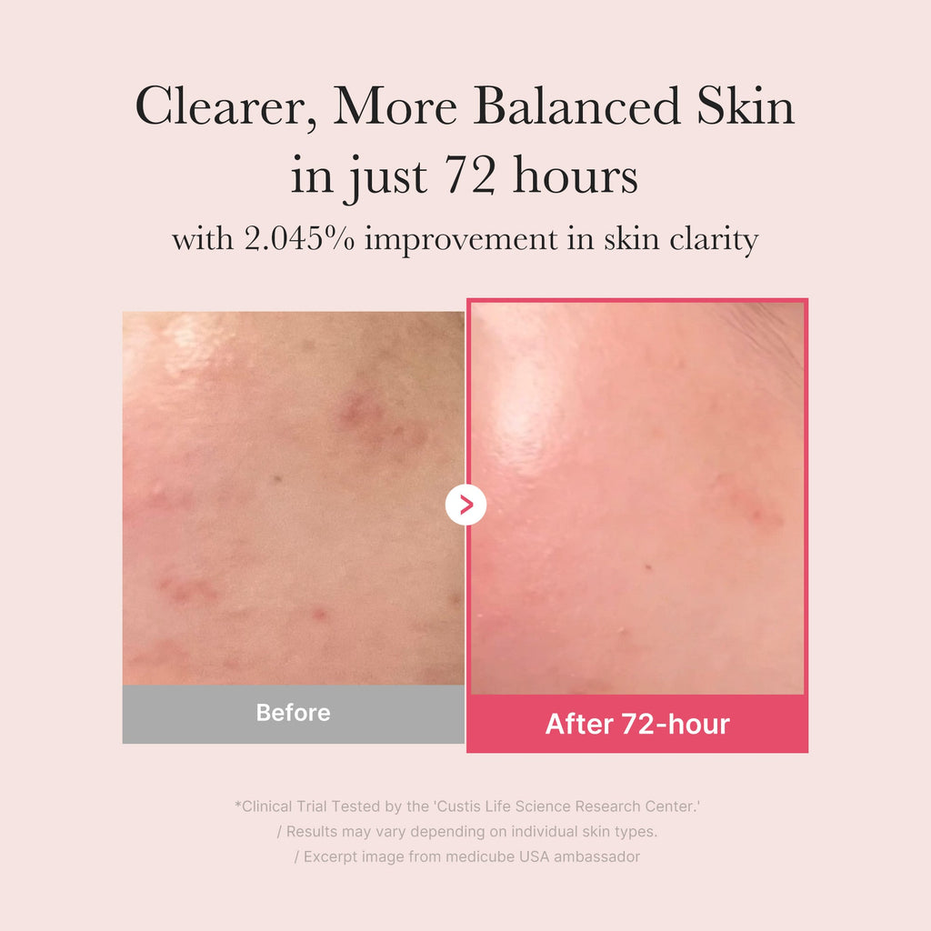 TXA Niacinamide Serum - Luxe Medicube Care