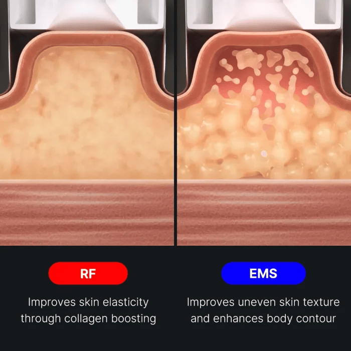 AGE-R Contour Body Shot - Daily Care Elevated